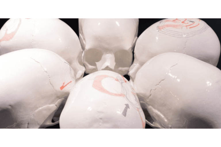 Thomas Fontaine - Moisand 2012-2013 (2)